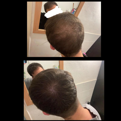 Ultimate Hair Growth Kit