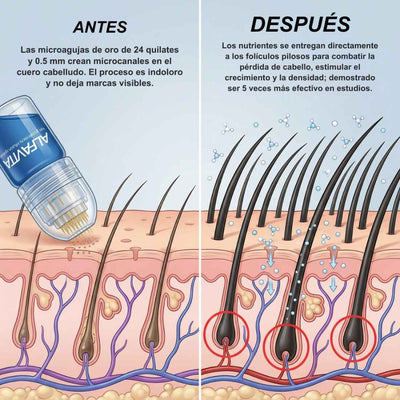 Alfavita™ Hair Regeneration System (2 months)