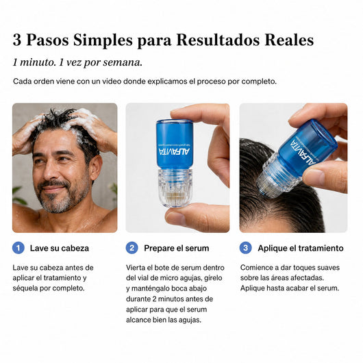 Alfavita™ Hair Regeneration System (2 months)