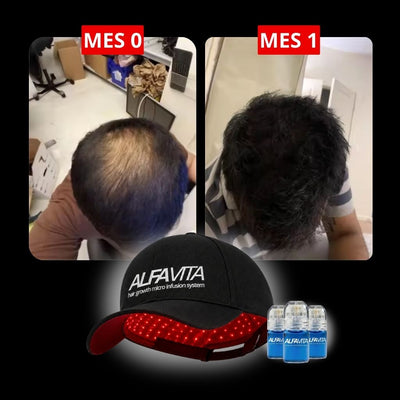 ACCELERATE YOUR RESULTS - RED LIGHT THERAPY CAP