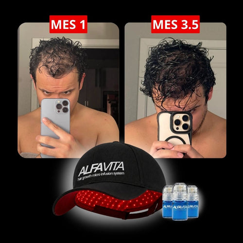 ACCELERATE YOUR RESULTS - RED LIGHT THERAPY CAP