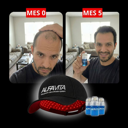 ACCELERATE YOUR RESULTS - RED LIGHT THERAPY CAP